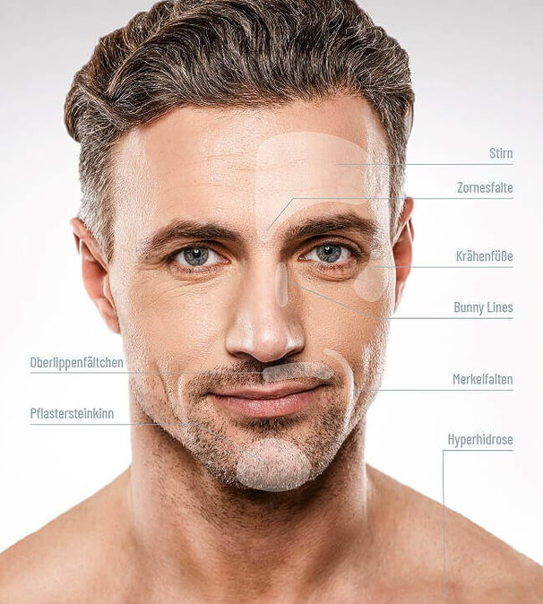 Anwendung Botox, Praxis Dermatologie Hamburg, Steinkraus Skin