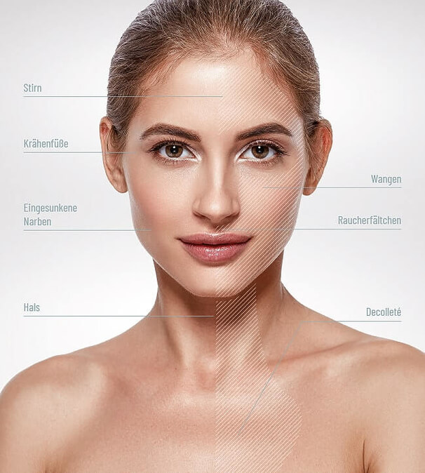 Hautverjüngung mit Skinbooster, Praxis Dermatologie Hamburg, Steinkraus Skin